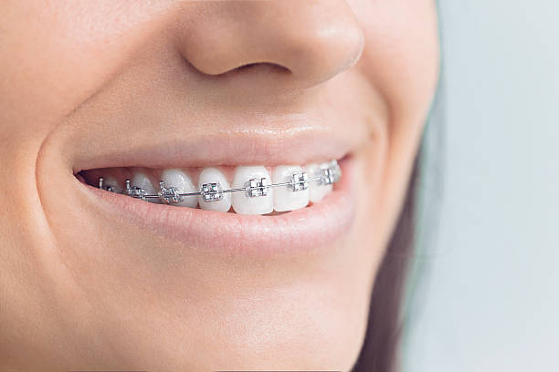 Best Traditional Braces  in Mcleansboro, IL